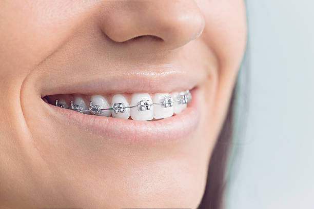 Best Full Mouth Reconstruction  in Hudson, CO